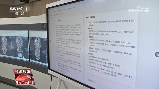 “AI+醫(yī)療”已成為熱門應(yīng)用領(lǐng)域 “AI醫(yī)生”如何輔助醫(yī)療？
